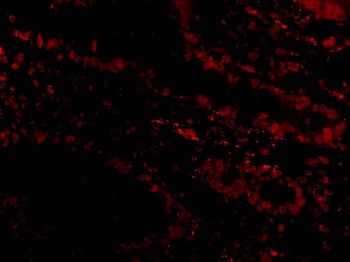 Livin Antibody