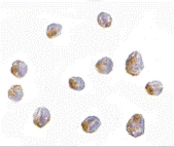 LIS1 Antibody
