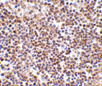 Lipe Antibody