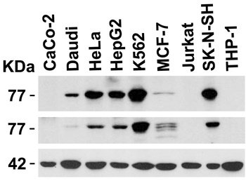 IRAK1 Antibody