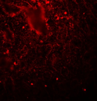 LIN28A Antibody