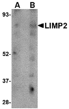 SCARB2 Antibody