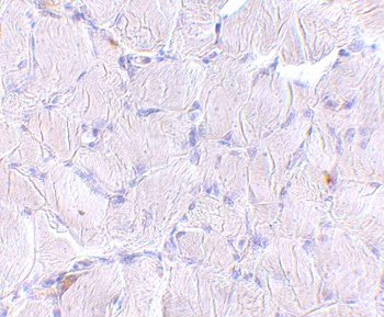 SCARB2 Antibody