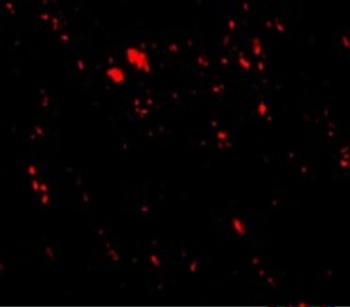 SCARB2 Antibody