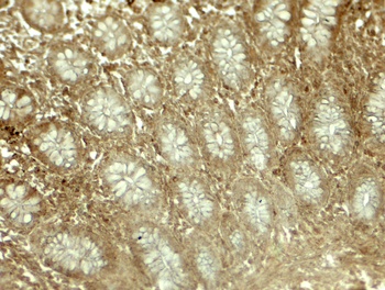 LIMA1 Antibody