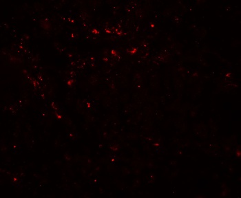LIMA1 Antibody