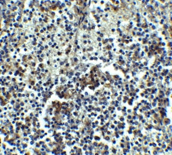 IRAK-M Antibody