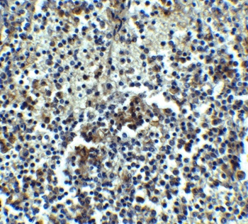 IRAK3 Antibody