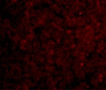 IRAK-M Antibody