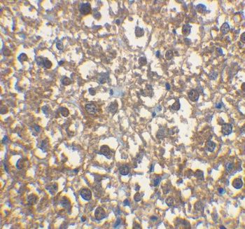 IRAK-M Antibody