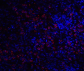 IRAK-M Antibody