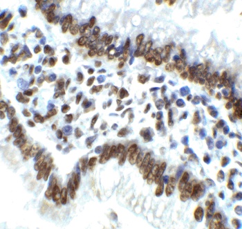 ERN1 Antibody