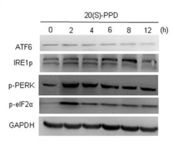 ERN1 Antibody