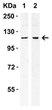 ERN1 Antibody