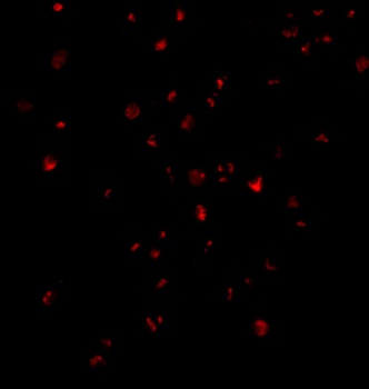 IRE1p Antibody