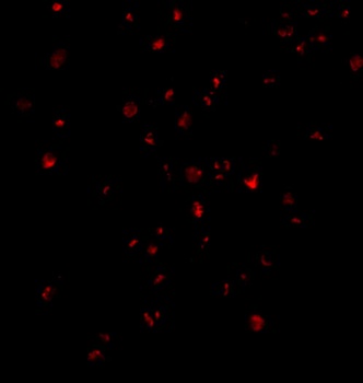 ERN1 Antibody