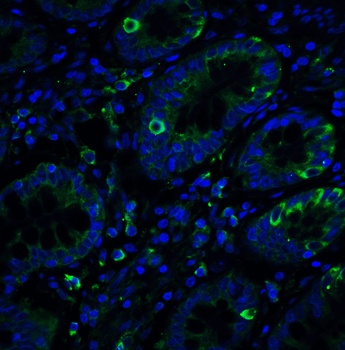 ERN1 Antibody