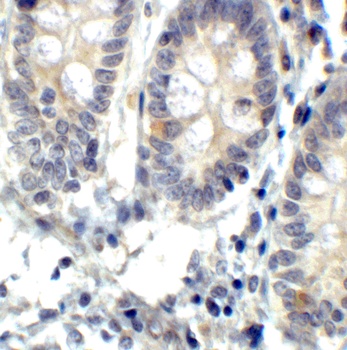 IRE1p Antibody