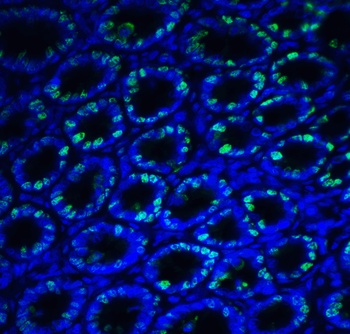 IRE1p Antibody