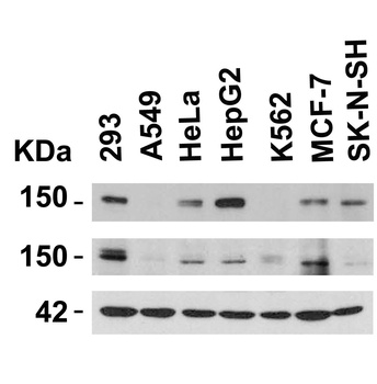 KDM3A Antibody