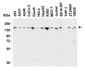 JMJD3 Antibody