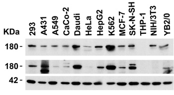 JMJD3 Antibody