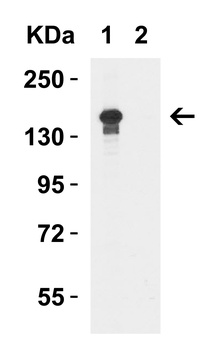 KDM6B Antibody