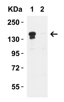 KDM6B Antibody