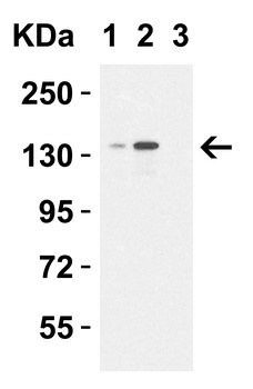 JMJD3 Antibody