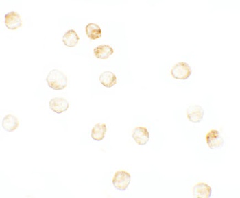 JMJD3 Antibody