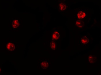JMJD3 Antibody