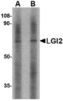 LGI2 Antibody