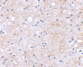 LGI1 Antibody