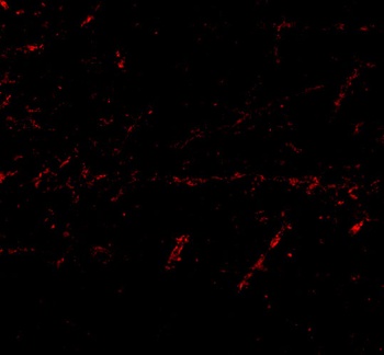 LGI1 Antibody