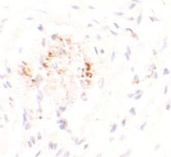 LEMD3 Antibody