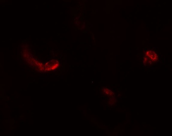 LEMD3 Antibody