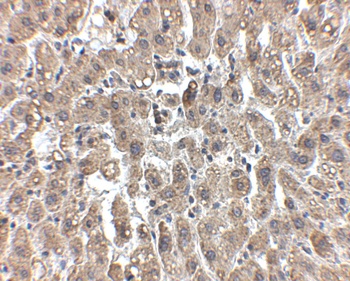 LDL-R Antibody