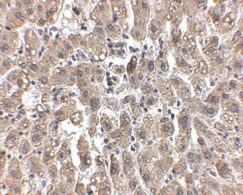 LDLR Antibody