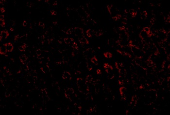 LDL-R Antibody