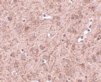 CERS6 Antibody