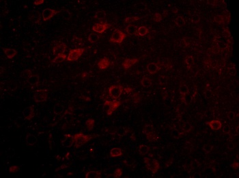 CERS6 Antibody