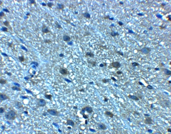 LANCL2 Antibody