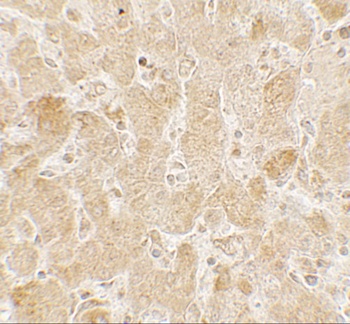 LAMTOR2 Antibody