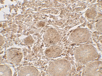 LAMTOR1 Antibody