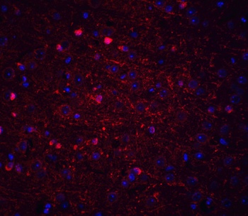 KIF5 Antibody