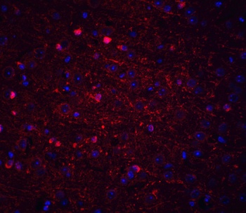 KIF5A Antibody