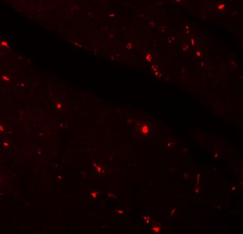 KLOTHO Antibody