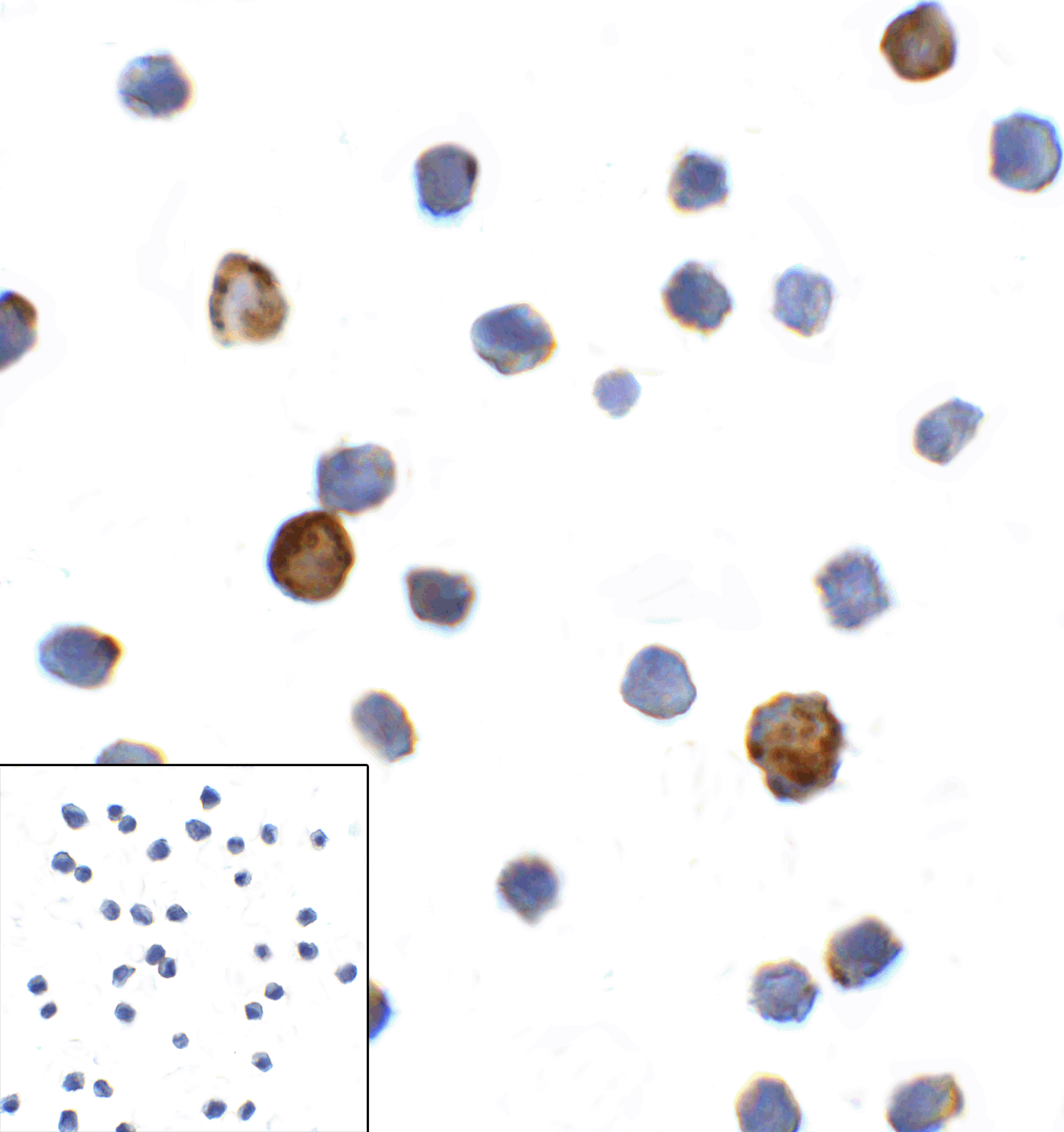 LAG3 Antibody [1G4]