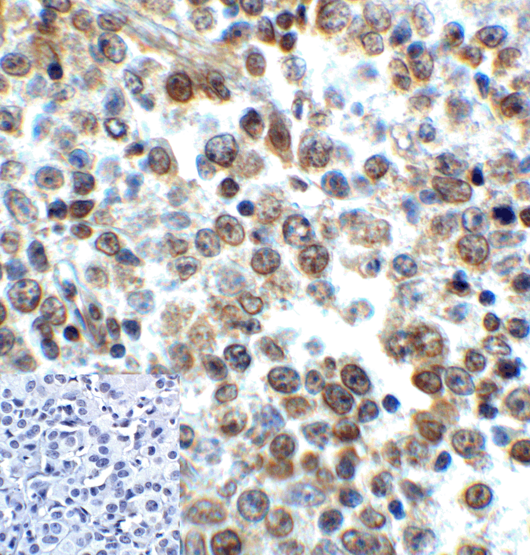 LAG3 Antibody [1G4]