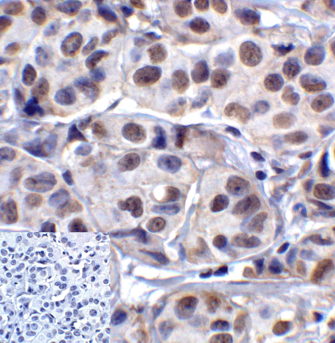 LAG3 Antibody [2G8]